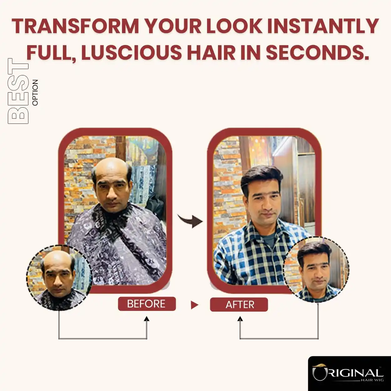 Natural Black Front Lace Hair Patch Easy Fix with Tape Glue and Clips